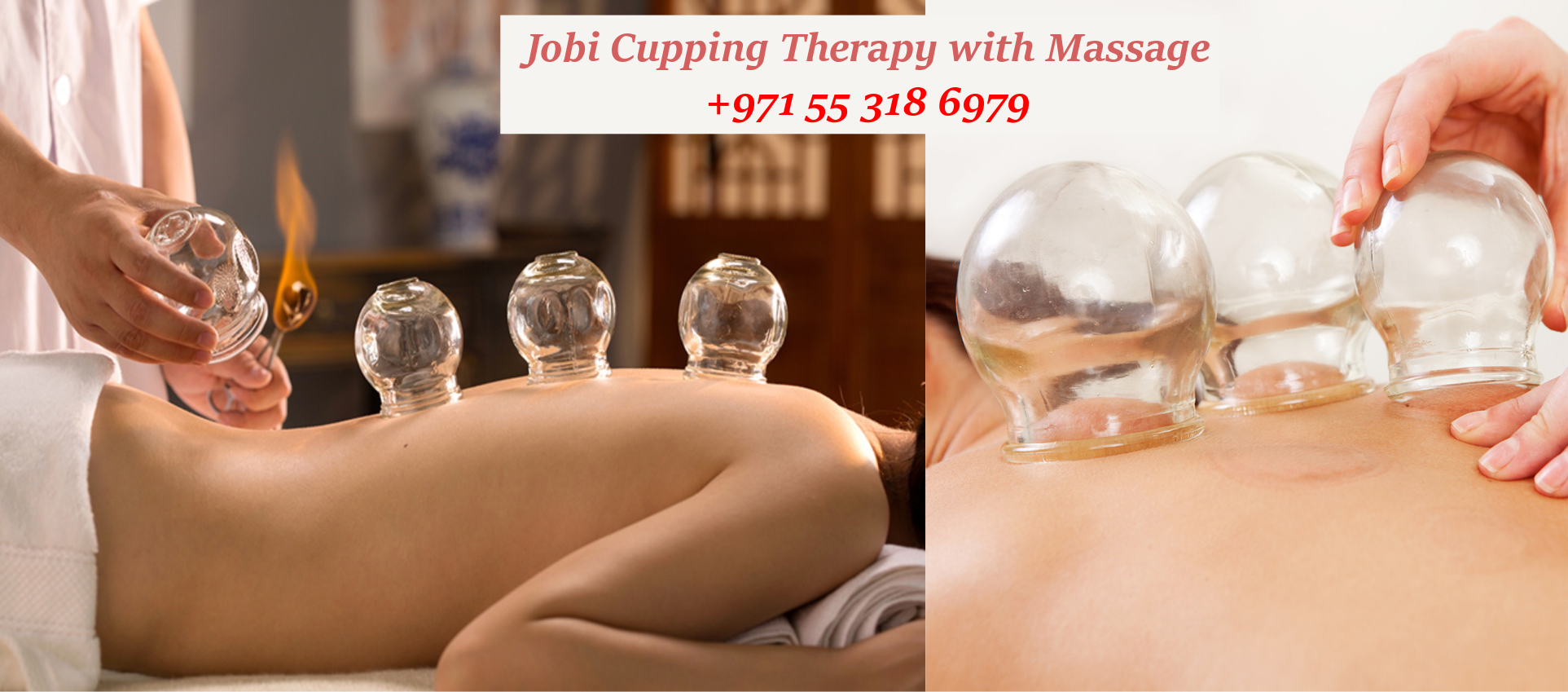 Jobi Cupping Therapy Header 1